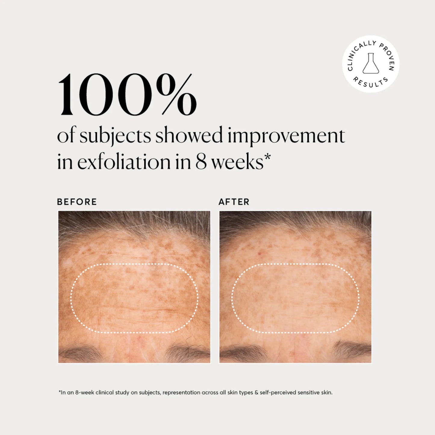 bha-liquid-exfoliant-2-h0 NATR-10027-Alt-Images-BHA-Liquid-Exfoliant-2_-03.webp